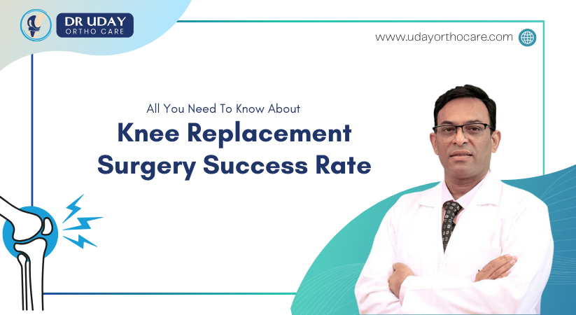 Knee Replacement Surgery Success Rate